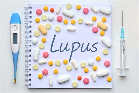 Lupus Síntomas Causas Y Tratamiento Muy Salud