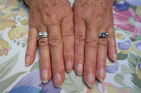 Discover the best way to prevent dry, cracked skin and cuticles, and to keep your nails and hands looking younger and healthy this winter. Learn What These 12 Nail Conditions Can Tell You About ...