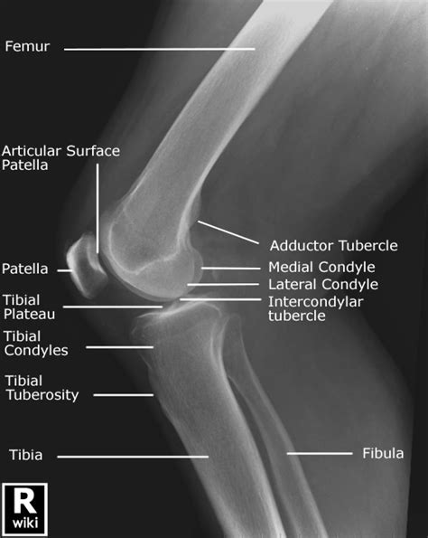 Knee Structure Diagram