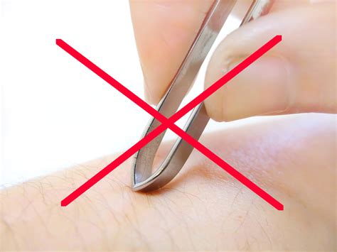 脱毛サロンで脱毛中の自己処理はどうする？NGの処理方法を ...