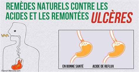 Mais revenons à notre astuce et comprenons comment faire pour calmer ces remontées gastriques acides ! Remèdes contre les remontées acides