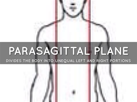 Parasagittal Plane Definition