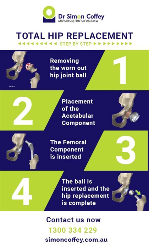 21 Best Total Hip Replacement Surgery Recovery Images On Pinterest