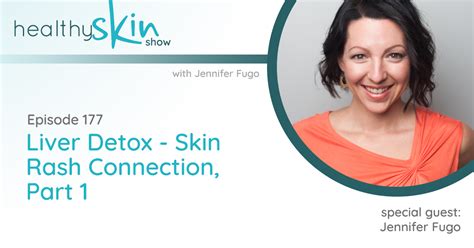177 Liver Detox Skin Rash Connection Part 1