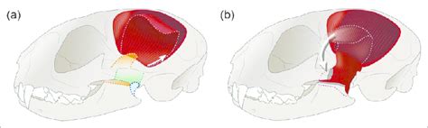 Schematic Drawing Of The Temporalis Myofascial Flap Transposition A