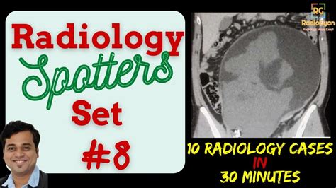 Radiology Core Exam Board Review 10 Spot Cases Quiz And Discussion