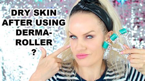 Dry Skin After Dermarolling? WATCH THIS! 