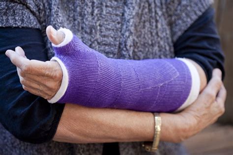 Ulnar Styloid Fractures Treatment Of A Broken Wrist