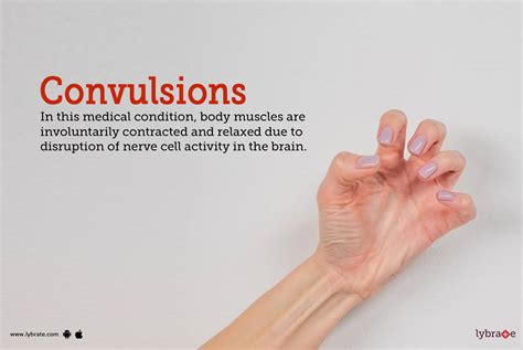 convulsions symptoms causes treatment cost and side effects