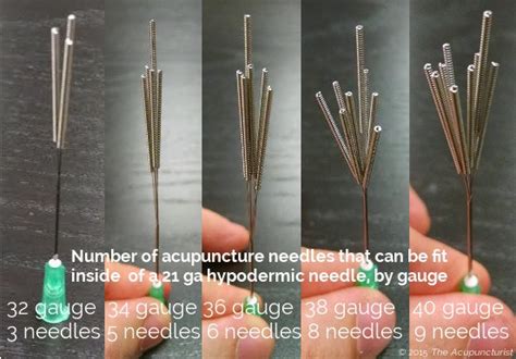 Needle Size Align Acupuncture