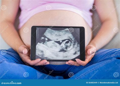 Pregnant Woman Showing Ultrasound Scans Stock Image Image Of Female