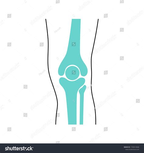 Vektor Stok Human Knee Symbol Knee Joint Meniscus Tanpa Royalti