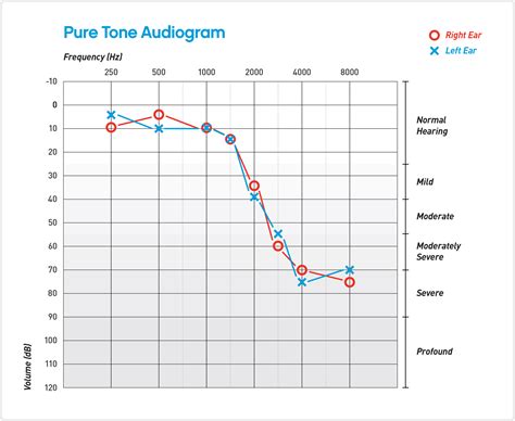 The results of an audiogram can help direct medical and. Understanding Your Audiogram - Sonic Blog