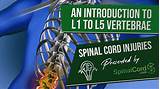 Ein typisches stromkabel(mantelleiter) besteht aus mehreren einzel isolierten kupferadern, die isolationsschichten sind in verschiedenen farben eingefärbt. Spinal Cord Injuries L1, L2, L3, L4, & L5 Vertebrae ...