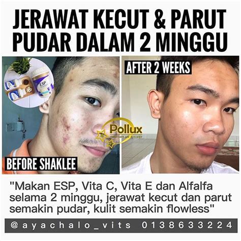 Setiap kali selepas minum monavie, tom akan sapu lebihan jus yang tertinggal pada cawan pada muka beliau. MALUNYA MUKA BERPARUT JERAWAT . Rileks jangan stress ...