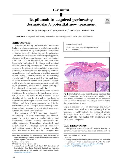 Pdf Dupilumab In Acquired Perforating Dermatosis A Potential New