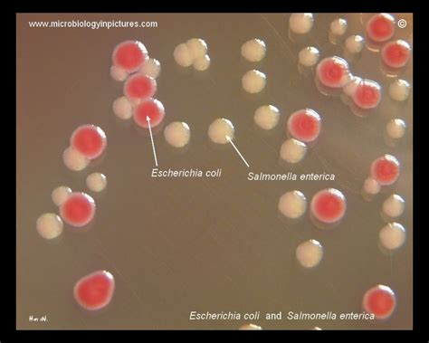 Salmonella And Li On Macconkey Agar Colonies Apperance And Growth