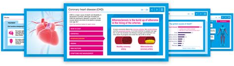Coronary Heart Disease eLearning Course : 4pt Limited