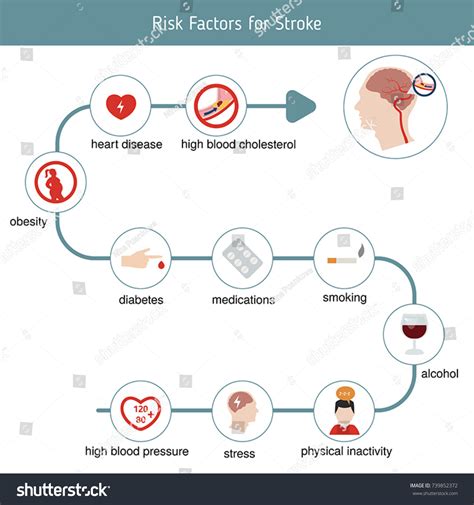 Infographics Stroke Stroke Risk Factors Vector เวกเตอรสตอก ปลอดคา