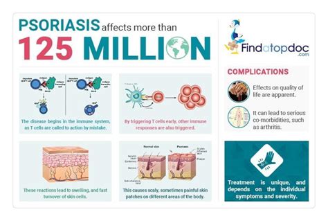 Psoriasis Symptoms Causes Treatment And Diagnosis Findatopdoc