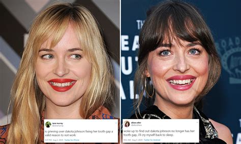 The commotion over johnson's teeth started when the actress, 29, was spotted at the los angeles. Get 22+ 28+ Cardi B Before She Fixed Her Teeth Images vector