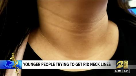 Vertebral, visceral and two vascular compartments. How to get rid of 'tech neck' — creases in your neck that ...
