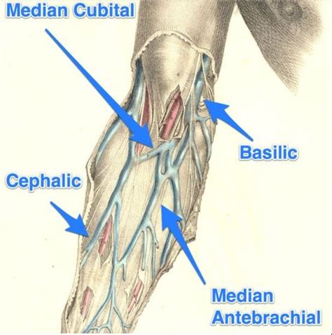 How To Find A Vein For Iv Unugtp News