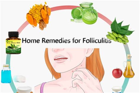 Natural Remedies For Folliculitis To Cure At Home Dubai Entertainment