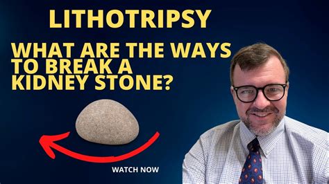 What Are The Types Of Lithotripsy How To Break A Stone Dr Kent Delay