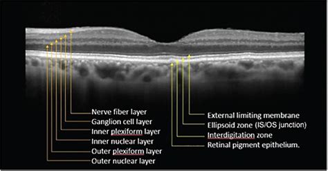 Layers Of Retina On Oct