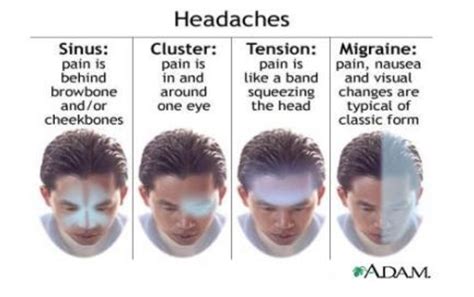 Headaches Tension Migraine Cluster Sinus Causes And Treatments