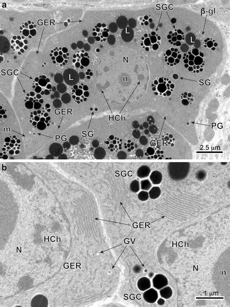 A And B Tem Micrographs Illustrating Advanced Stages Of Vitellocyte