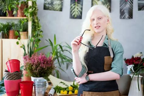 Can Albino People Dye Their Hair Discover The Surprising Truth The