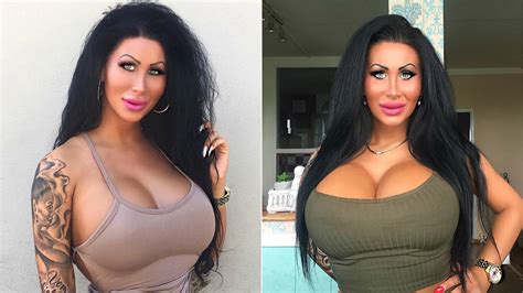 A Woman From Berlin Spent Nearly 39 000 On Plastic Surgery To Look