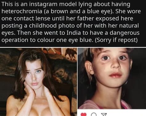 This Is An Instagram Model Lying About Having Heterochromia A Brown
