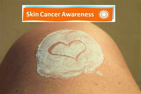 The sun is the top cause of skin cancer, but you can face additional risks based on your lifestyle choices. Skin Cancer Awareness - Mum, Thats Me