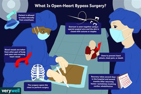 Heart Bypass Surgery Preparation Recovery Long Term Care