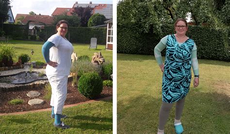 Lipödem en çok hangi hastalıklar ile karışır? Lipödem Blog: Ich und mein Lipödem | FRAUENSACHE