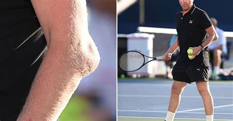 Boris Becker Appears To Be Suffering From Severe Tennis Elbow With Huge