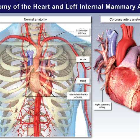 Anatomy Of The Heart And Left Internal Mammary Artery Trialexhibits Inc