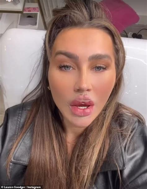 Lauren Goodger Shows Off Her New Plump Pout After Undergoing The Same