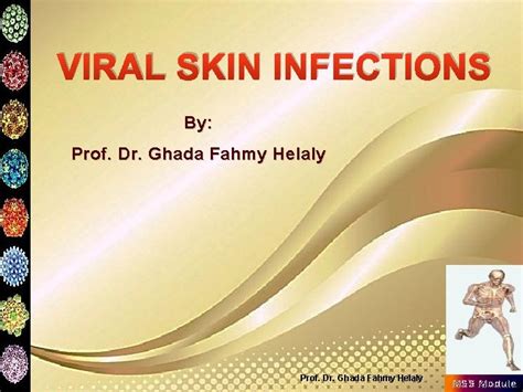 Prof Dr Ghada Fahmy Helaly Viral Skin Infections