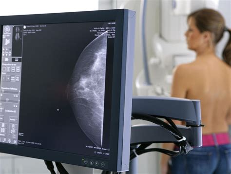 Как выглядит рак молочной железы на снимке маммографии может ли