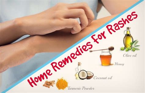 Home Remedies For Rashes Heat Rash Baby Rashes Allerg