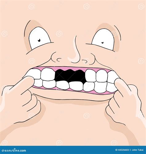 Missing Teeth Stock Vector Image Of Symbol Illustration 44326603