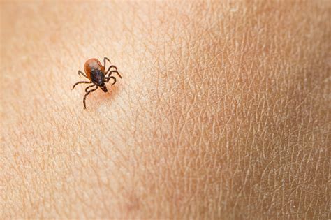 Ticks And Lyme Disease Tick Season Is Still Here What To Know To