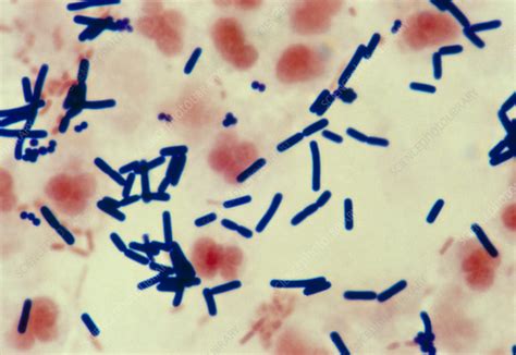 Clostridium perfringens enterotoxin (cpe) is responsible for food poisoning. Clostridium perfringens bacteria from wound - Stock Image ...