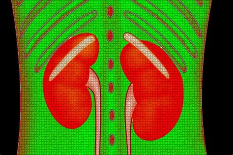 Chronic kidney disease kills more than 1M people annually worldwide