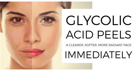 Glycolic Acid Chemical Peel Kit Anti Aging Anti Wrinkle Etsy
