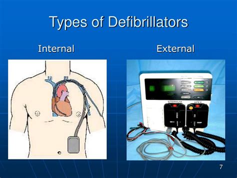 Ppt Defibrillators Powerpoint Presentation Free Download Id3675518